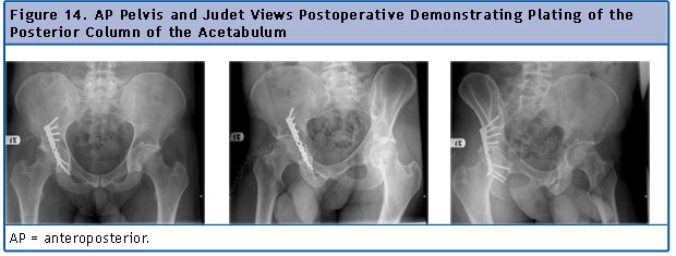 Imaging Pelvic Fractures Eradimagingcom Rt Ce 